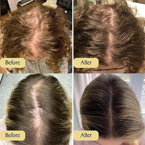 Hair Care Essential Oil